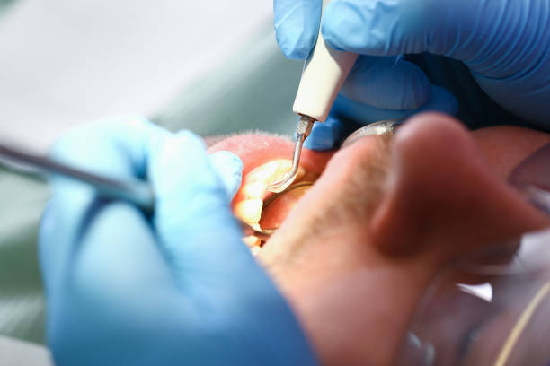 Best Pediatric Emergency Dentist in Hopelawn, NJ