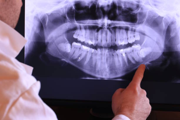 Best Emergency Treatment for Toothache in Hopelawn, NJ
