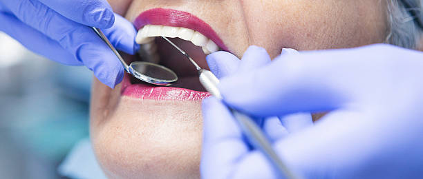 Best Emergency Tooth Extraction in Hopelawn, NJ